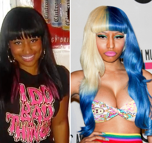 Nicki-Minaj-Before-and-After-Plastic-Surgery
