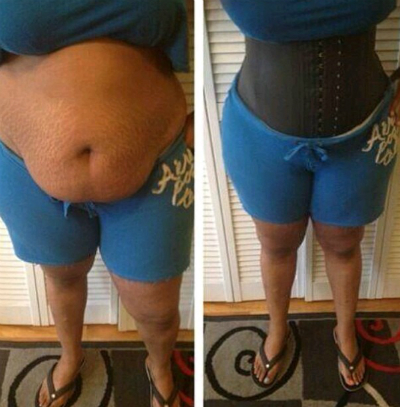 Before and After Waist Trainer
