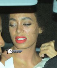 Solange Knowles gets covered by sister Beyonce as they leave Solange's wedding reception party. Solange appears to have had some kind of allergic reaction as she was seen with large spots over her face and neck. Sister Beyonce moved very quickly to hide Solange's face in the back of the car as photographers took pictures of the new bride.