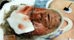 richard fletcher beaten by baltimore teens