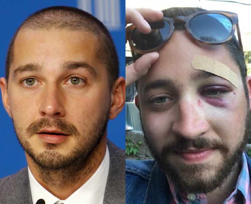 New York Man Gets Knocked Out For Shia LaBeouf