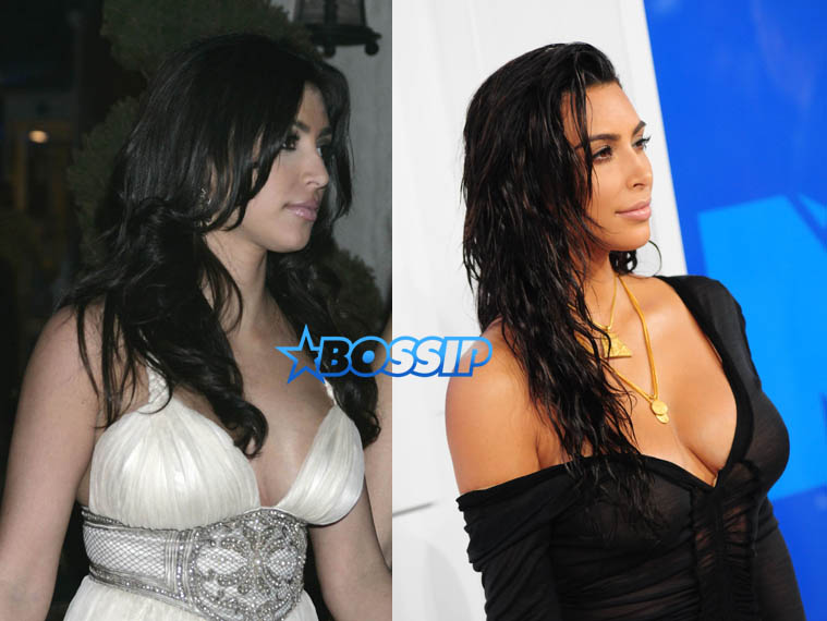 Kim Kardashian before and after photos, did she have a nose job WENN