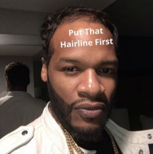 hairlinefirst