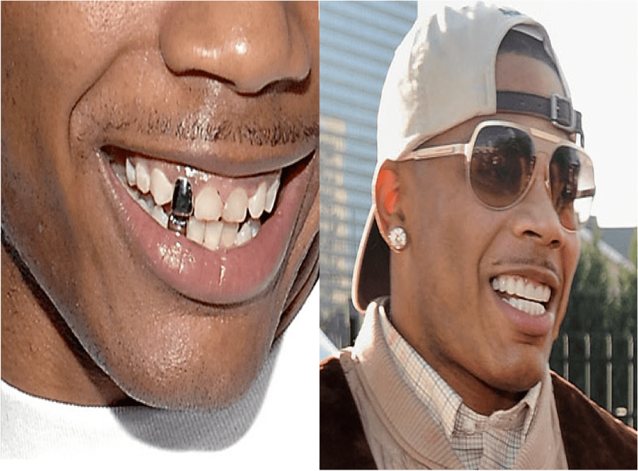 Page 2 of 9 5 Rappers That Got Traded In Grills For Perfect Teeth