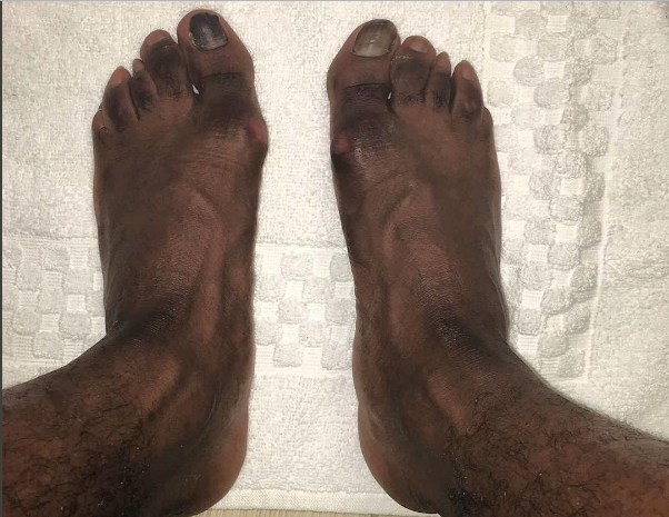 Adrien Broner says God finessed him in the foot department