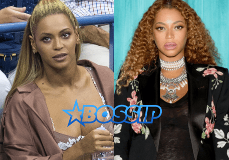 Has Beyonce Gotten Her Grammy Winning Pout Plumped Full Of Lip Filler?