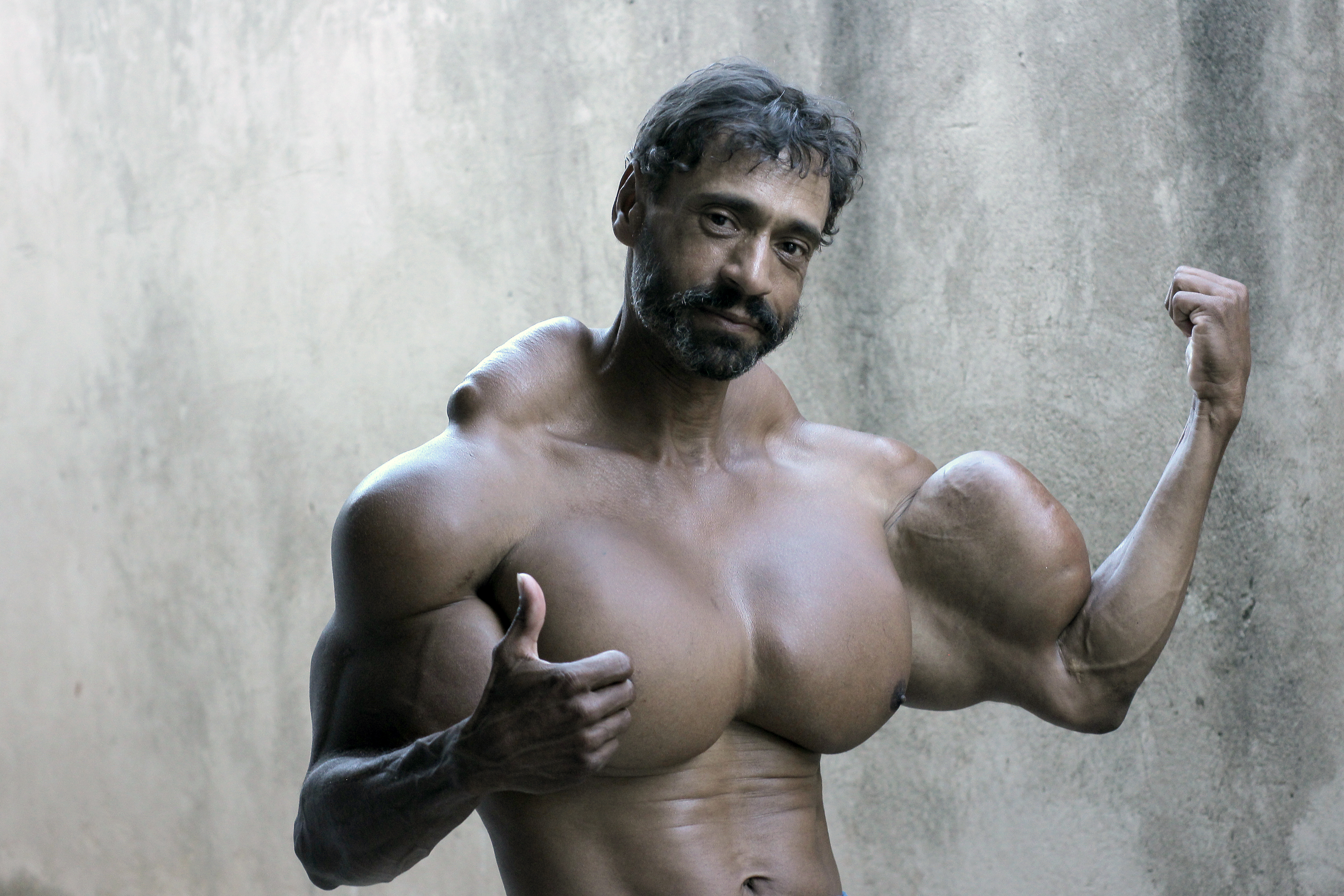 Rio's Hulk Brothers Don't Care If Synthol Injections Kill Them