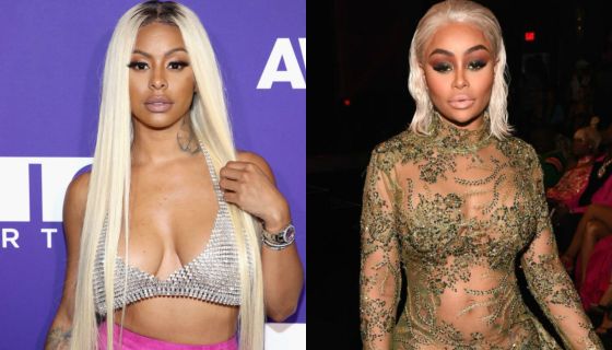 How Did Alexis Skyy Look Before Surgery? Fans Are Not Shocked