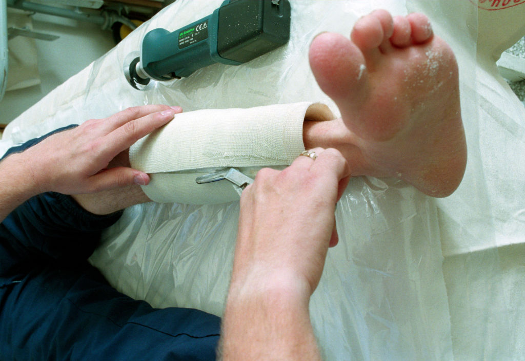 After a plaster is cut through in A&E with the plaster cutting saw, the nurse will then cut through the bandage underneath with a pair of bandage scissors.