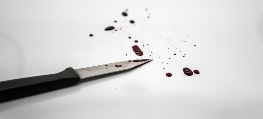 Close-Up Of Knife With Blood On White Background