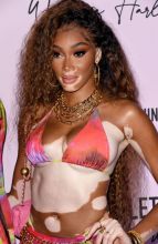 Winnie Harlow x Pretty Little Thing