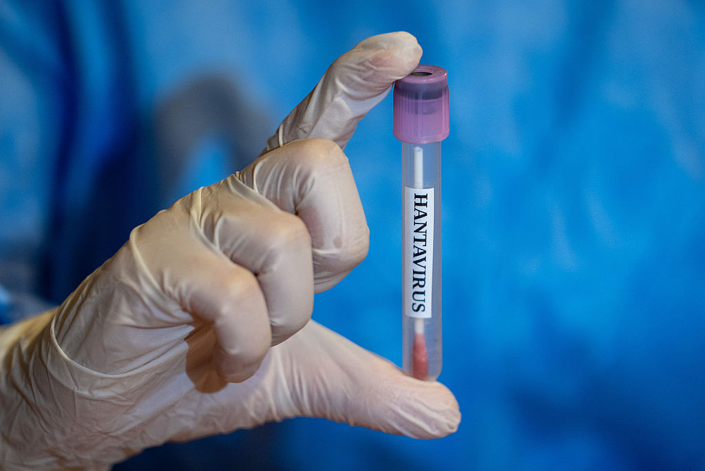 Hantavirus update as 2 Georgia Residents monitored Hantavirus update as 2 Georgia Residents monitored